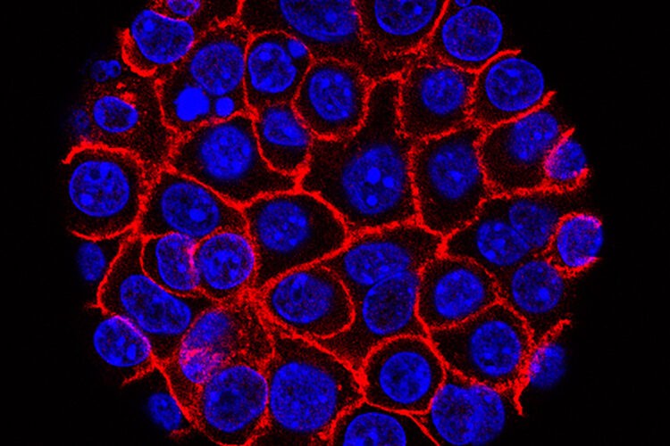 Experimental pill promises new hope for deadly pancreatic cancer | News ...